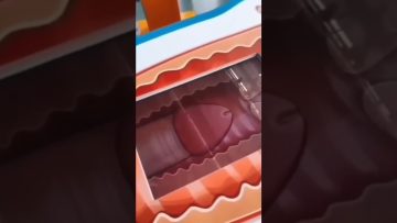[ID: HdDiuG6r9Eo] Youtube Automatic